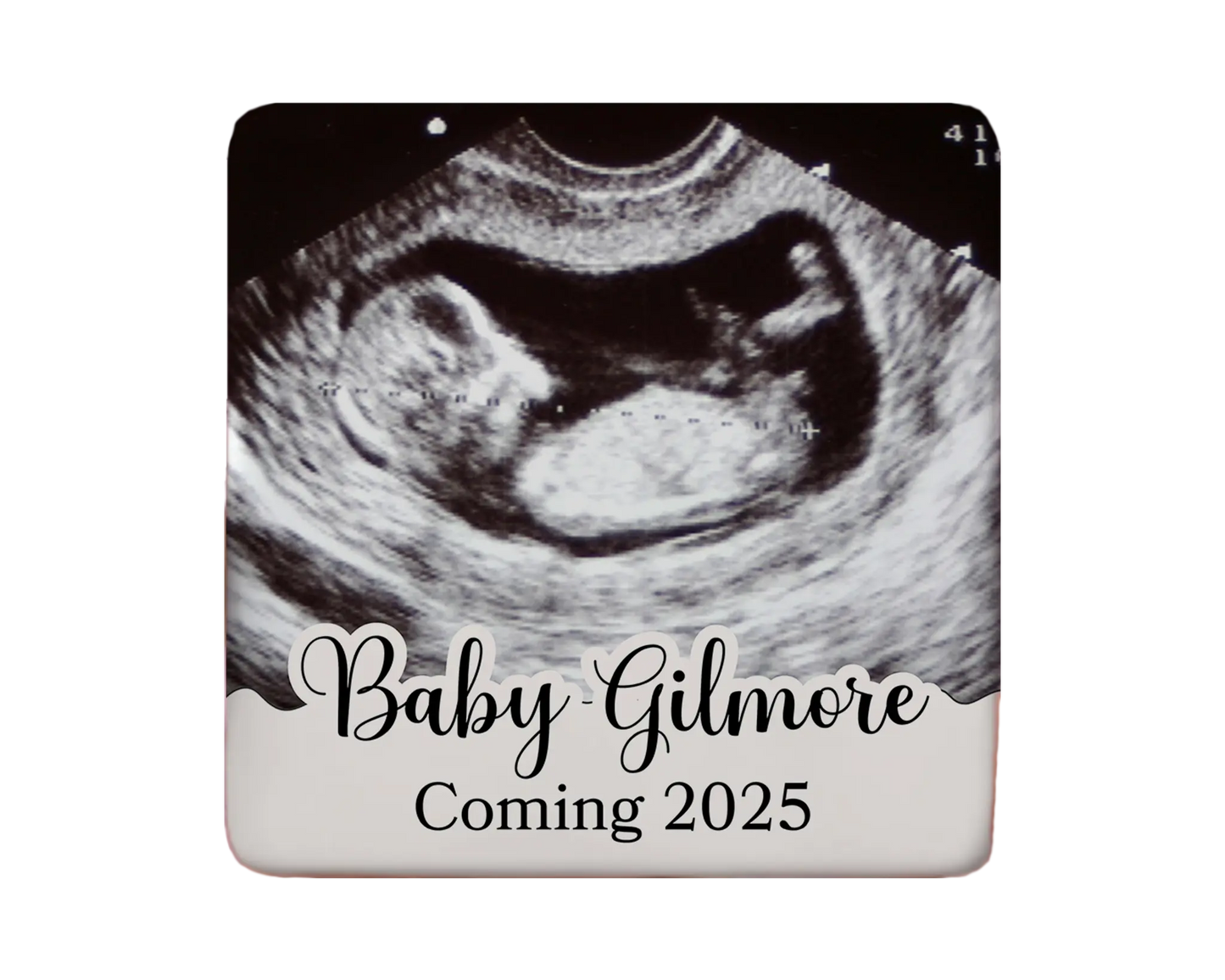 Ultrasound Magnet Custom Personalized Gift Souvenir Present