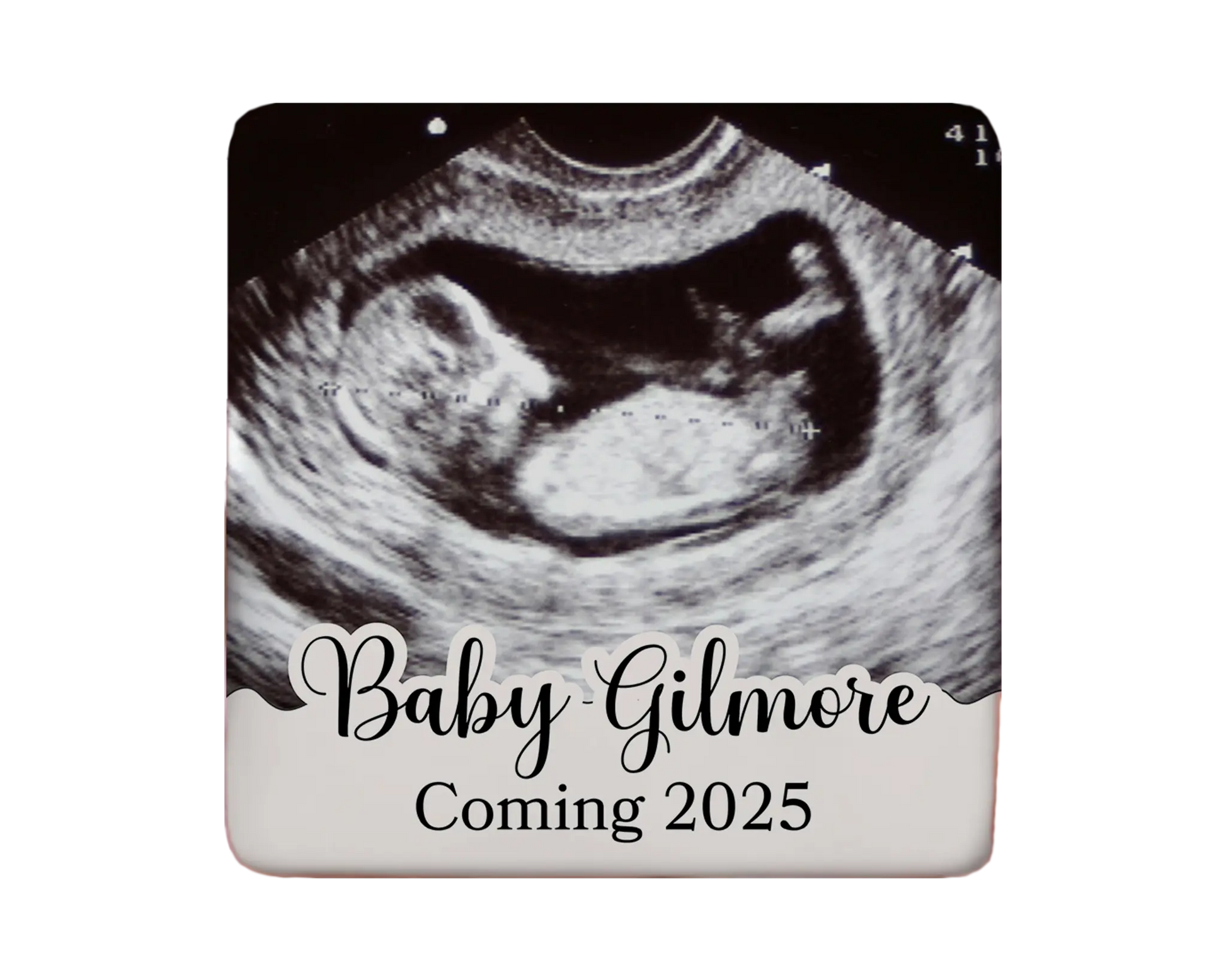 Ultrasound Magnet Custom Personalized Gift Souvenir Present