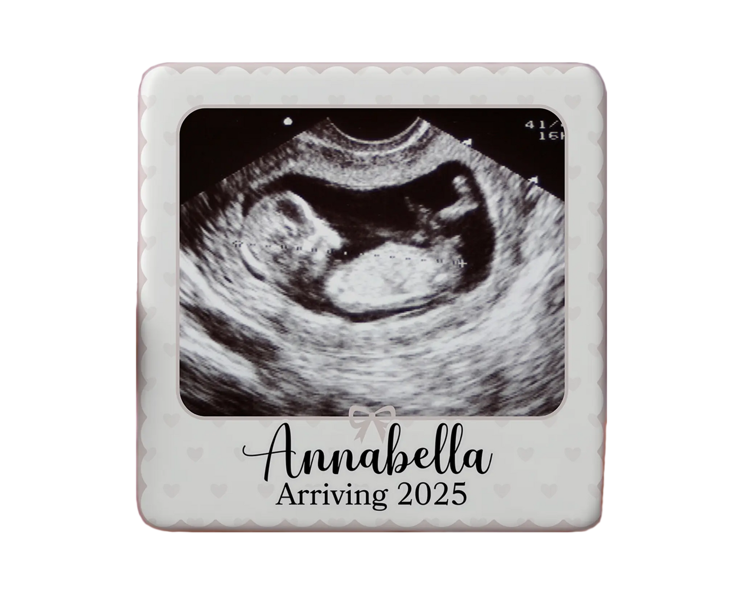 Ultrasound Magnet Custom Personalized Gift Souvenir Present