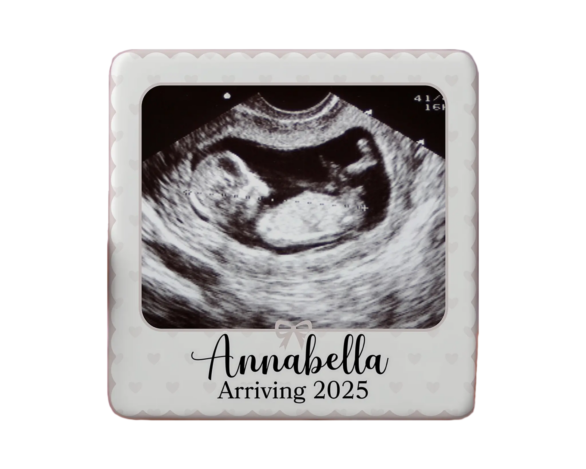 Ultrasound Magnet Custom Personalized Gift Souvenir Present