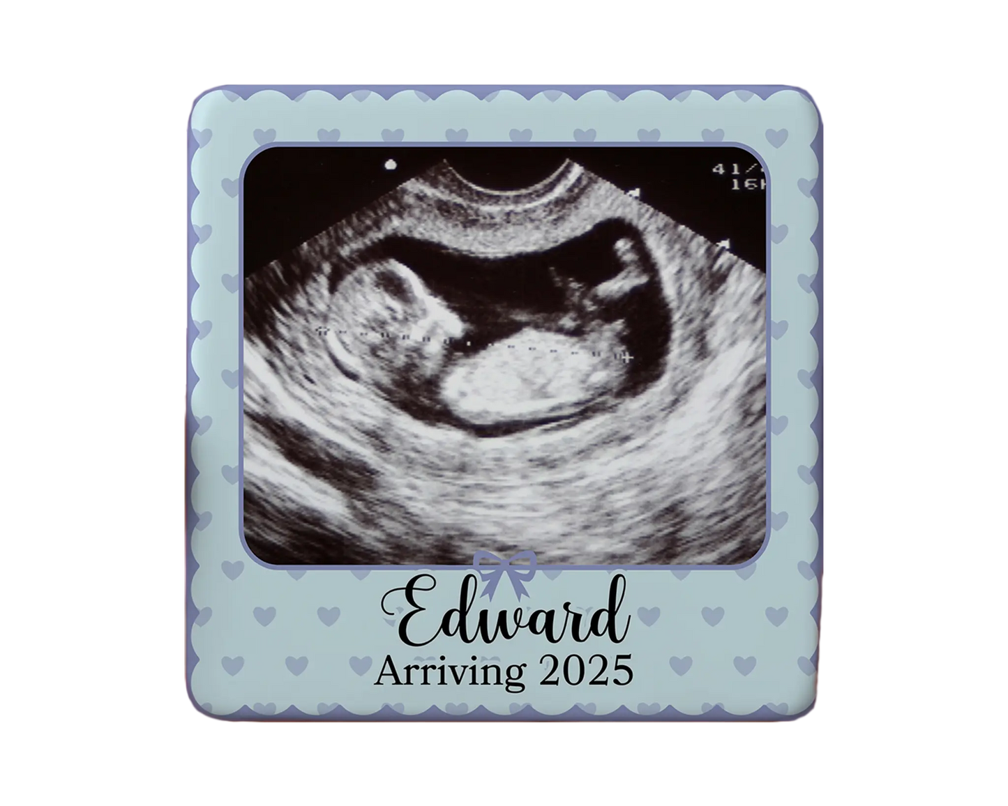 Ultrasound Magnet Custom Personalized Gift Souvenir Present