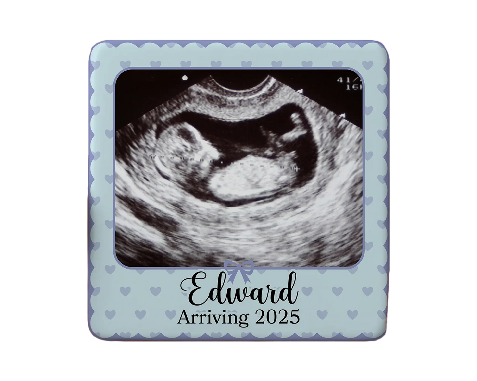 Ultrasound Magnet Custom Personalized Gift Souvenir Present