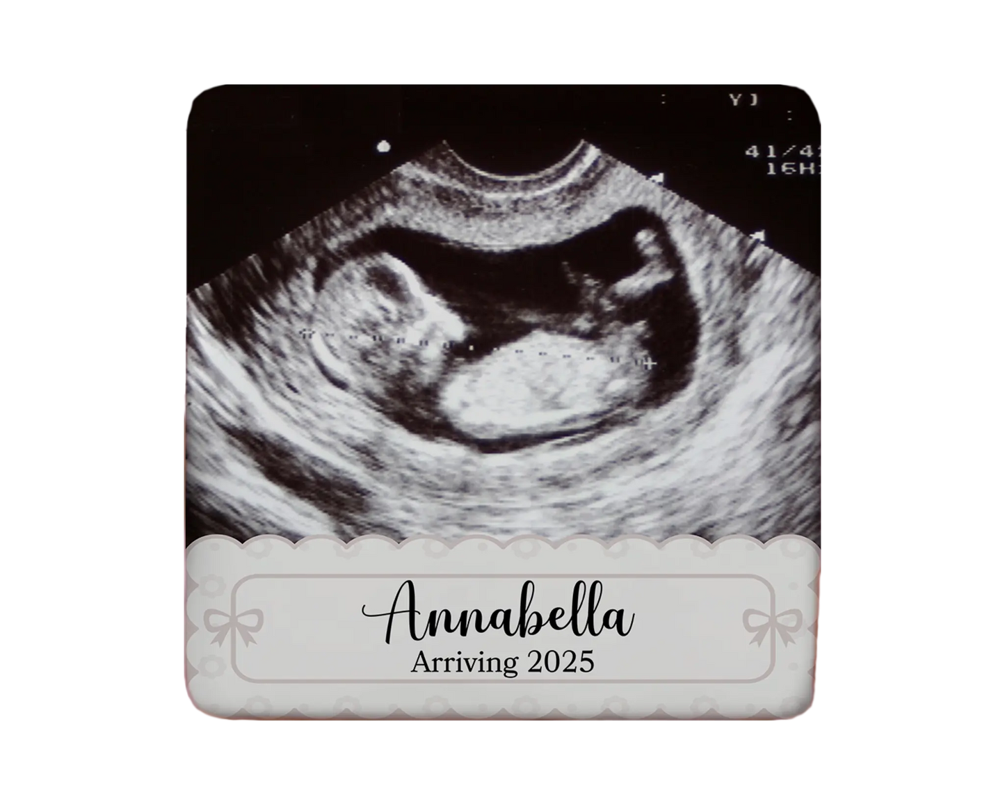 Ultrasound Magnet Custom Personalized Gift Souvenir Present