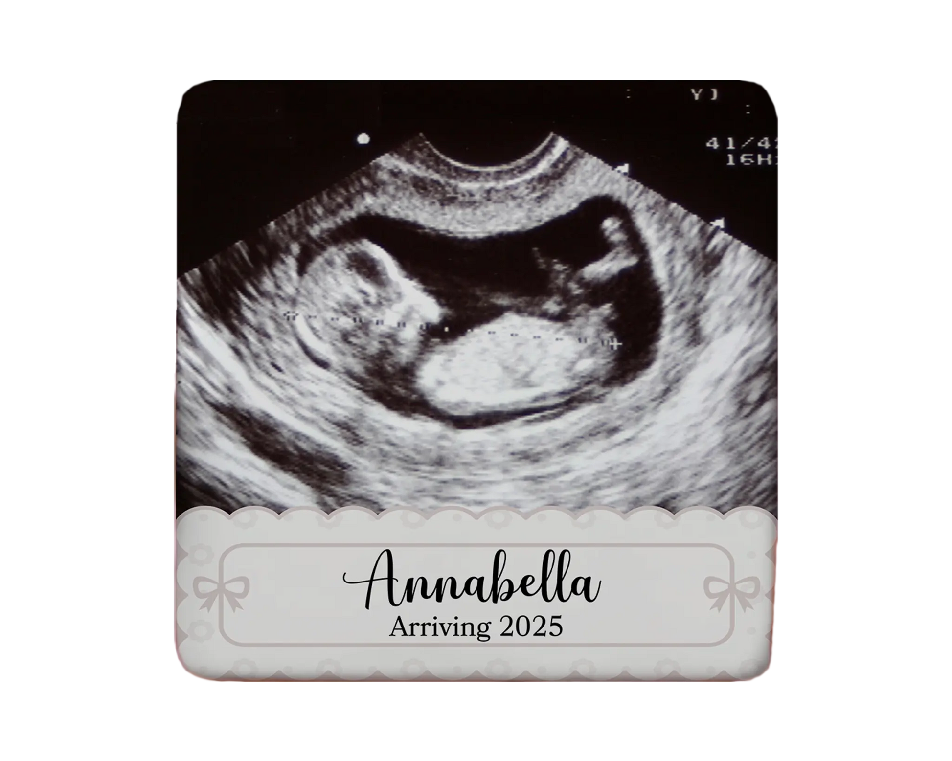 Ultrasound Magnet Custom Personalized Gift Souvenir Present