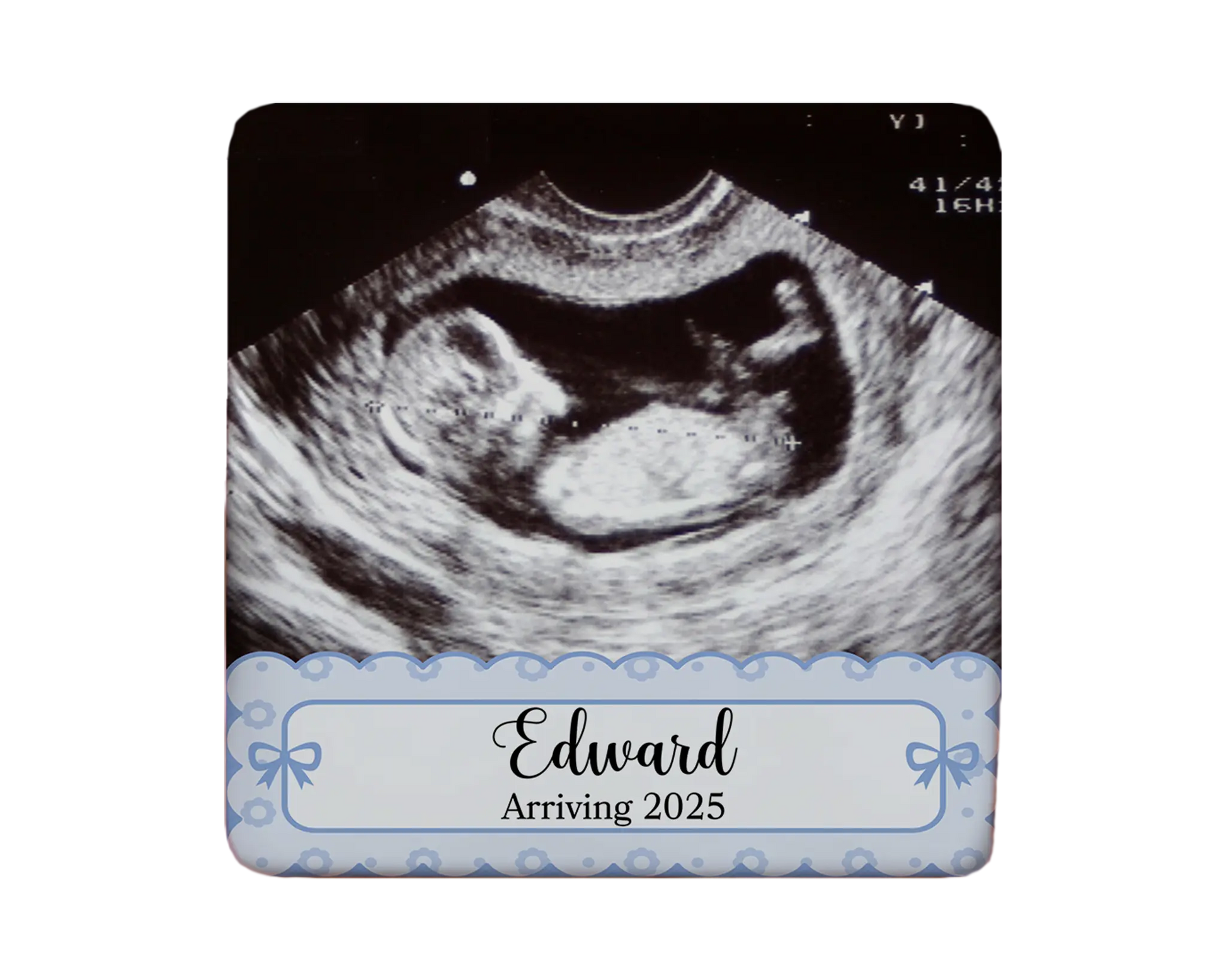 Ultrasound Magnet Custom Personalized Gift Souvenir Present