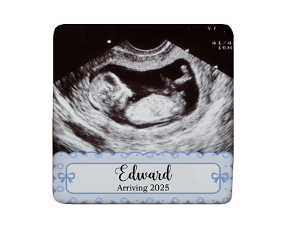 Ultrasound Magnet Custom Personalized Gift Souvenir Present