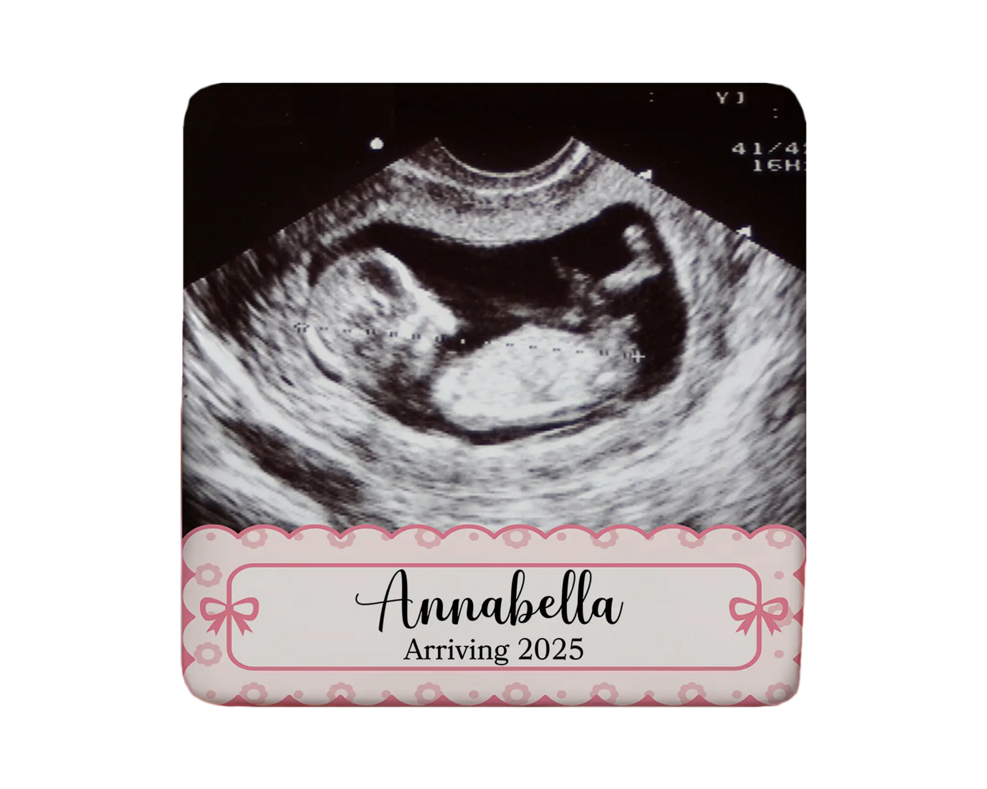 Ultrasound Magnet Custom Personalized Gift Souvenir Present