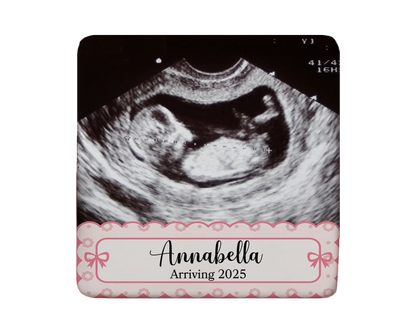 Ultrasound Magnet Custom Personalized Gift Souvenir Present