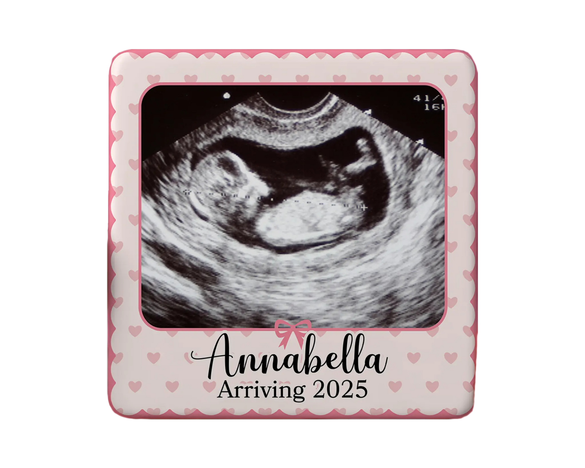 Ultrasound Magnet Custom Personalized Gift Souvenir Present