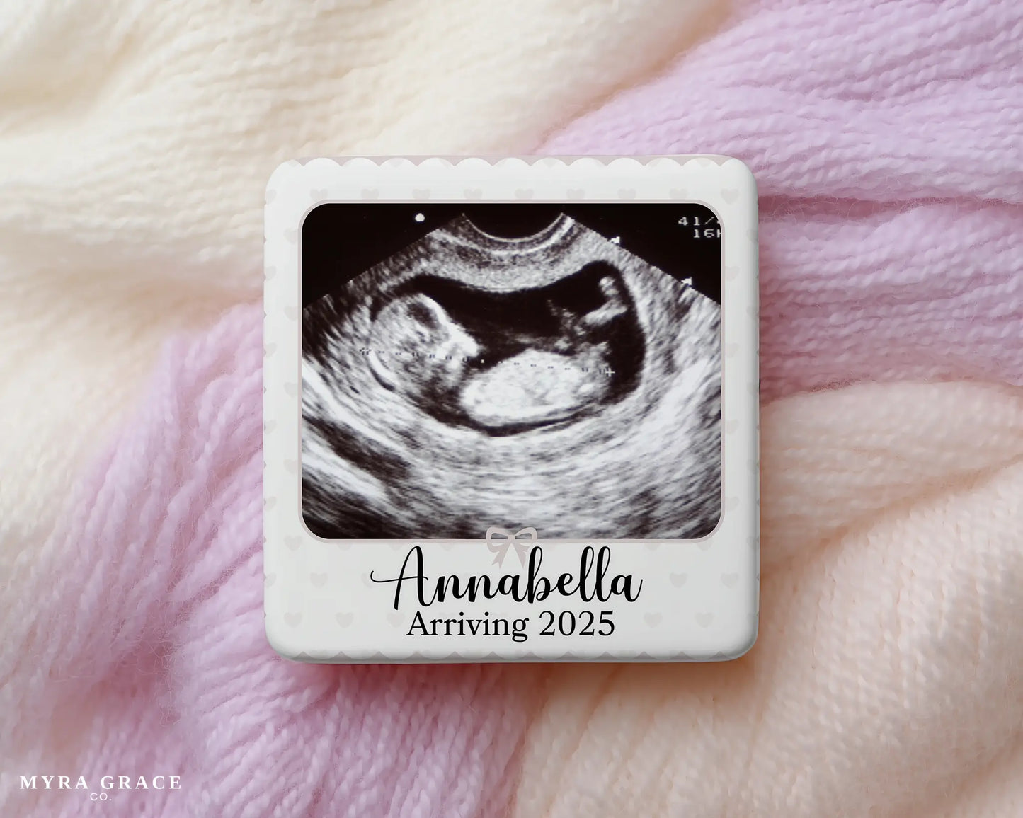 Ultrasound Magnet Custom Personalized Gift Souvenir Present