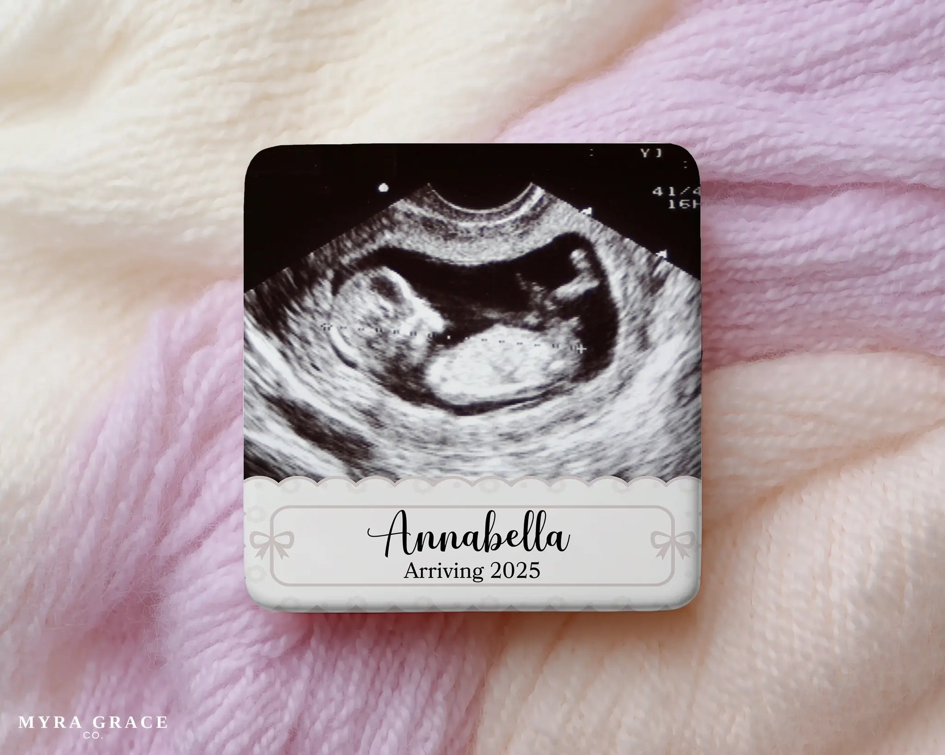 Ultrasound Magnet Custom Personalized Gift Souvenir Present