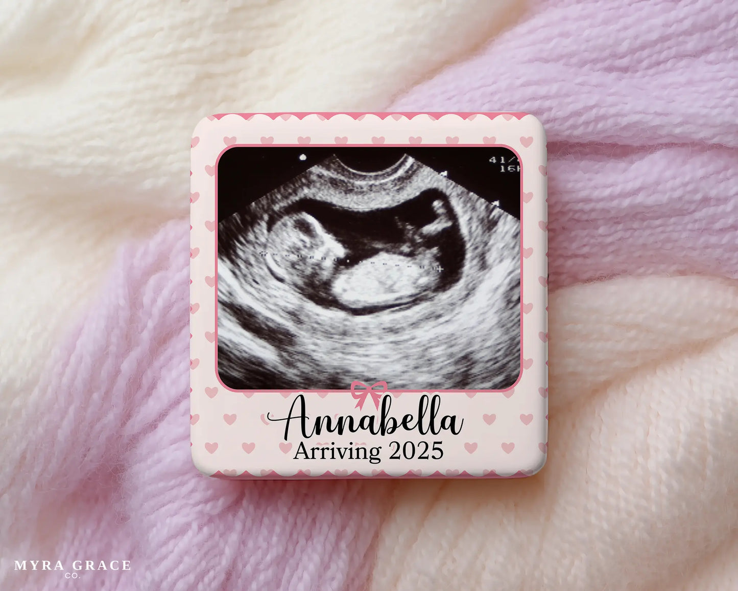 Ultrasound Magnet Custom Personalized Gift Souvenir Present