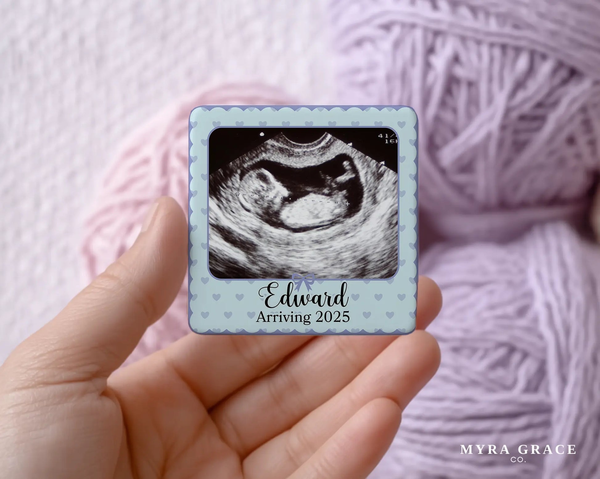 Ultrasound Magnet Custom Personalized Gift Souvenir Present