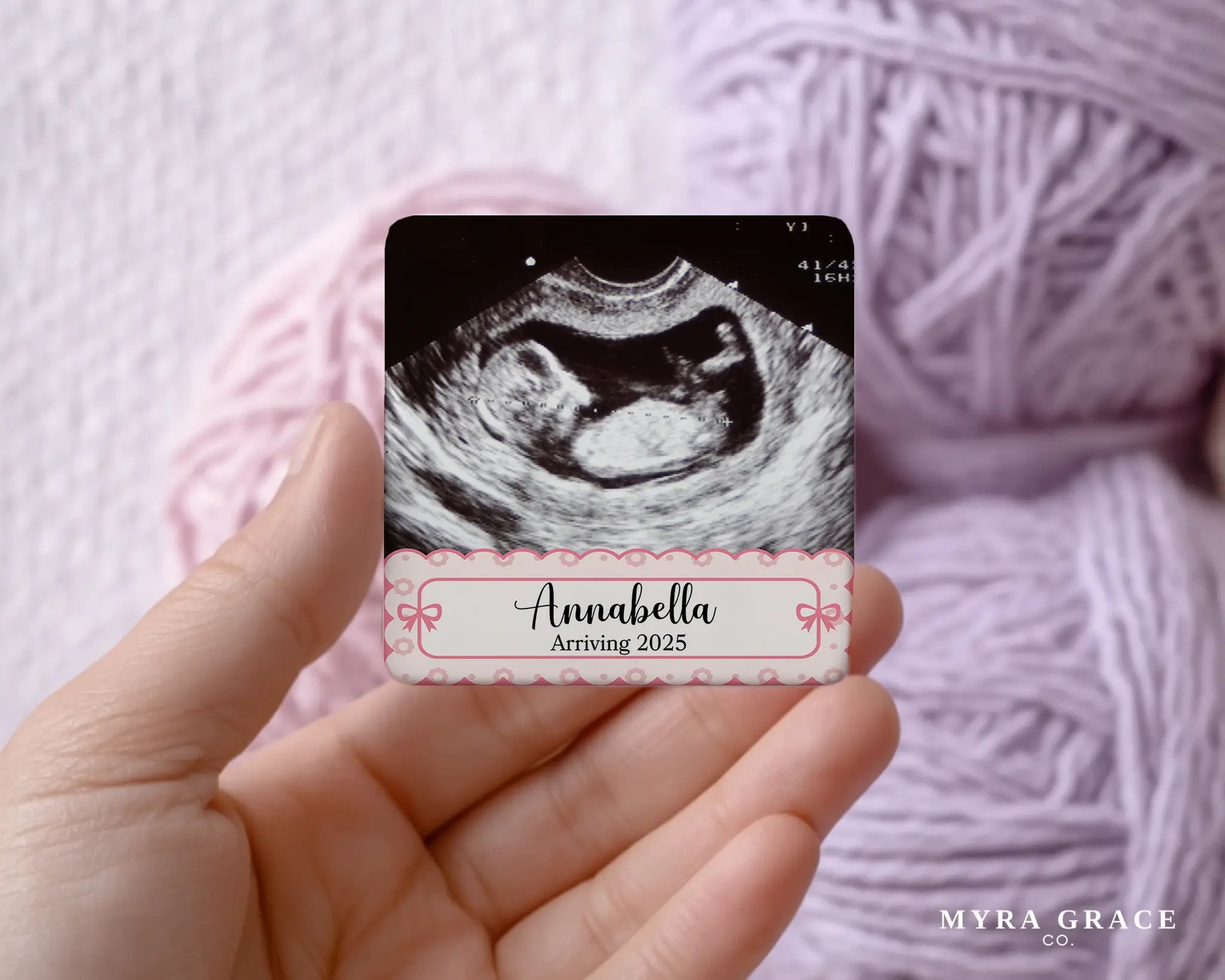 Ultrasound Magnet Custom Personalized Gift Souvenir Present